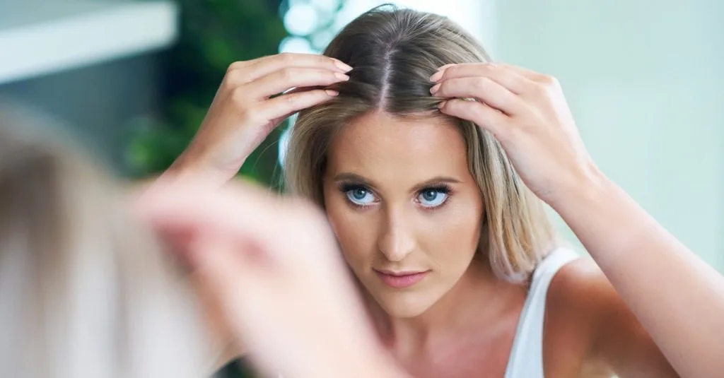minoxidil trị rụng tóc hói đầu soi gương đường chân tóc