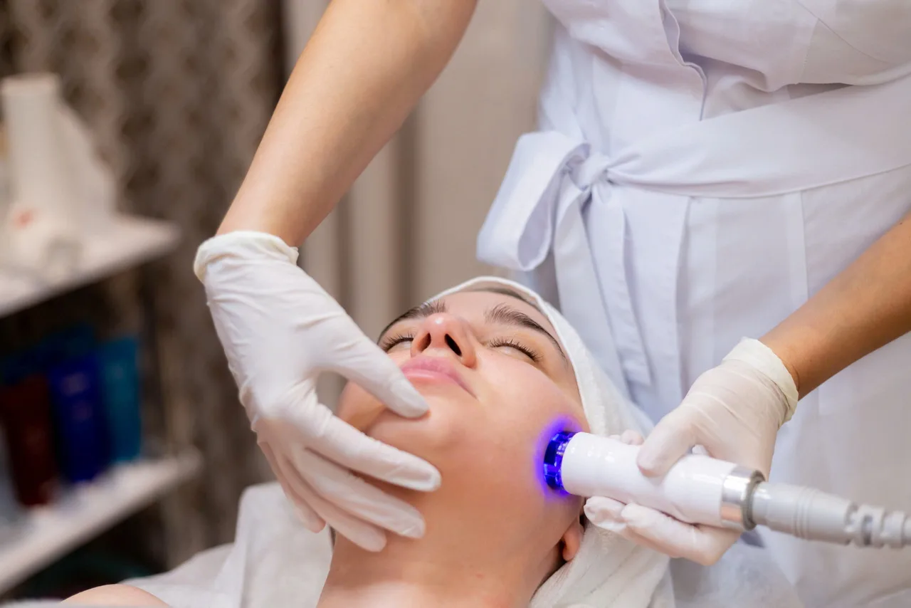 cô gái trị sẹo mụn bằng phương pháp laser