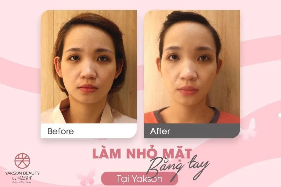 liệu pháp golki liệu pháp golki