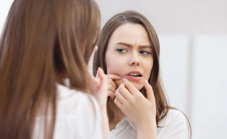 cách trị mụn 04 cách trị mụn 04