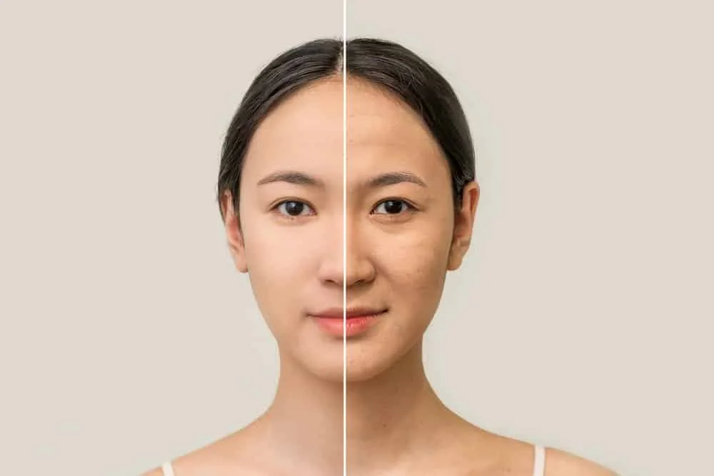 Giải pháp ngăn ngừa lão hóa. Giải pháp ngăn ngừa lão hóa.