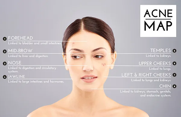 Các chuyên gia da liễu nói gì về mụn nội tiết? Các chuyên gia da liễu nói gì về mụn nội tiết?