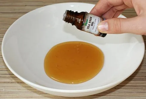 Cách trị mụn trứng cá bằng tinh dầu tràm trà 3