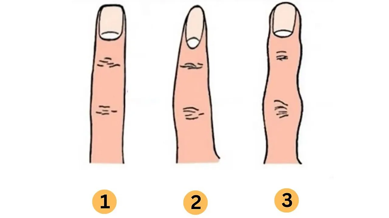 trắc nghiệm hình ảnh ngón tay