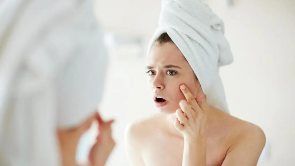 Không tẩy trang trước khi ngủ là sai lầm nguy hiểm nhất! Lỗ chân lông bị tắc nghẽn sinh ra mụn là những hậu quả tất yếu của việc không tẩy trang trước khi đi ngủ