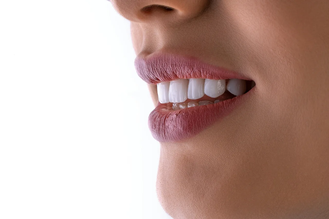 Đường tiếp giáp khít sát giữa răng sứ và nướu giúp ngăn ngừa vi khuẩn và hôi miệng.