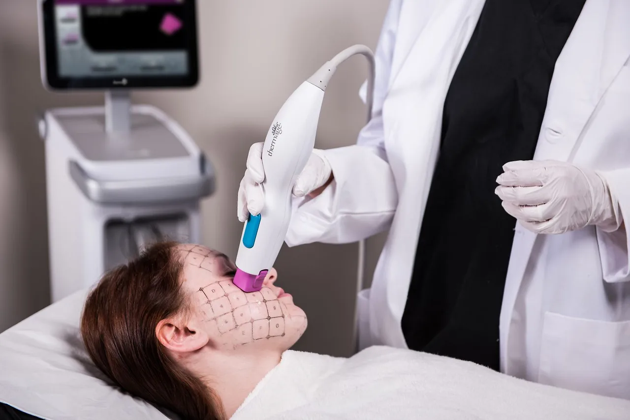 Công nghệ không xâm lấn Thermage với ngành công nghiệp làm đẹp Việt Nam.