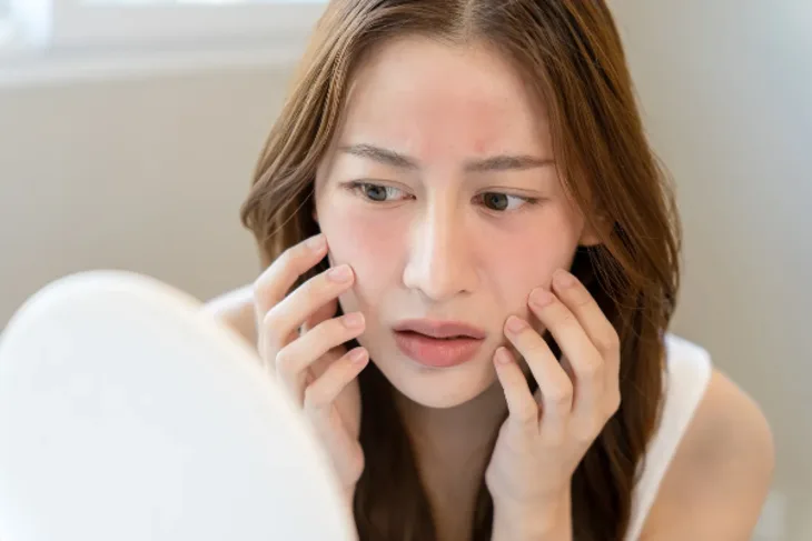 Làn da nhạy cảm. Làn da nhạy cảm.