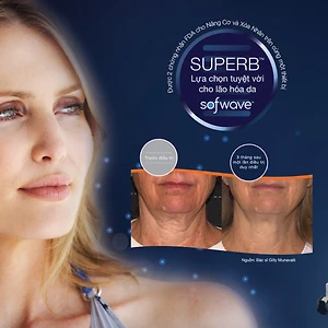 Việt Can ra mắt siêu phẩm Sofwave – Công nghệ độc quyền SUPERB™ cho nâng cơ và xóa nhăn
