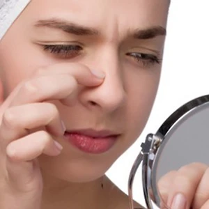 3 công thức mặt nạ trị mụn cám