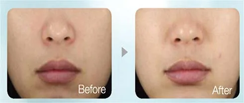hinh laneige 3