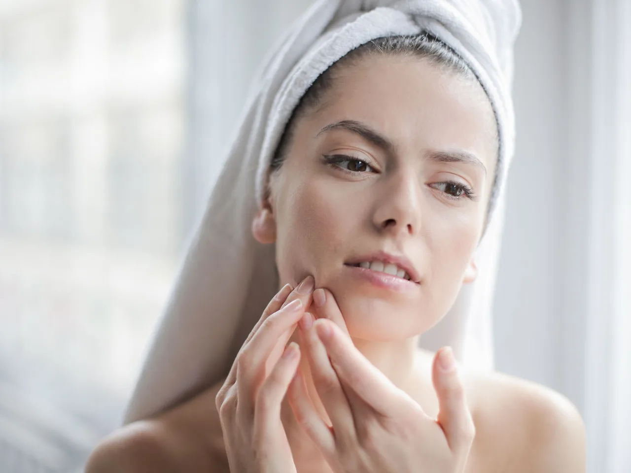 Da dầu mụn cần điều chỉnh skincare routine mùa Hè để phù hợp với thời tiết nóng ẩm.