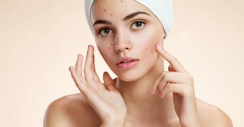 Công dụng của nước hoa hồng 7 Công dụng của nước hoa hồng 7