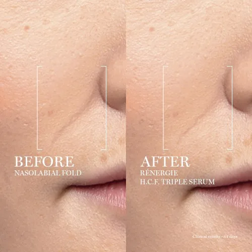sản phẩm chống lão hóa Lancôme Renergie H.C.F Triple Serum sản phẩm chống lão hóa Lancôme Renergie H.C.F Triple Serum
