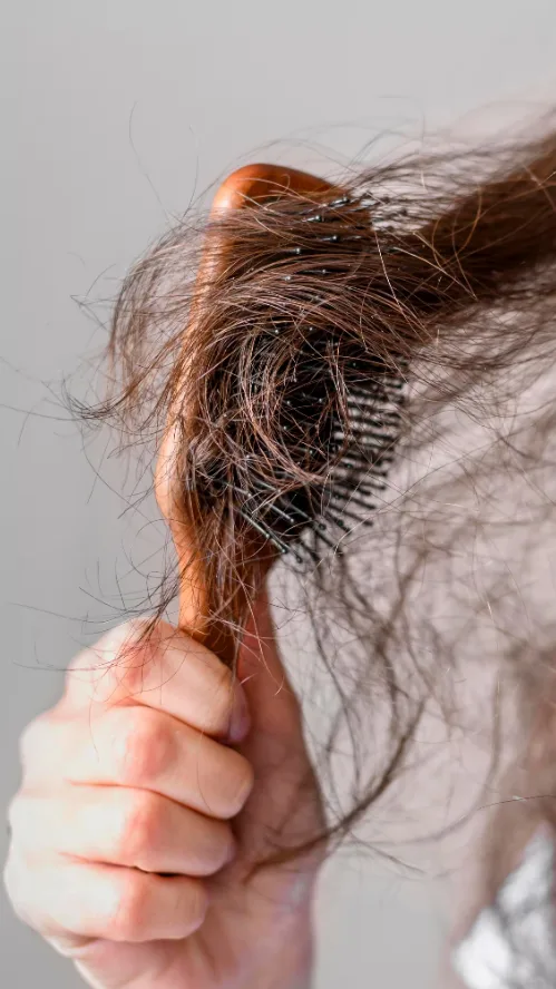 Minoxidil và công dụng trị hói, rụng tóc.