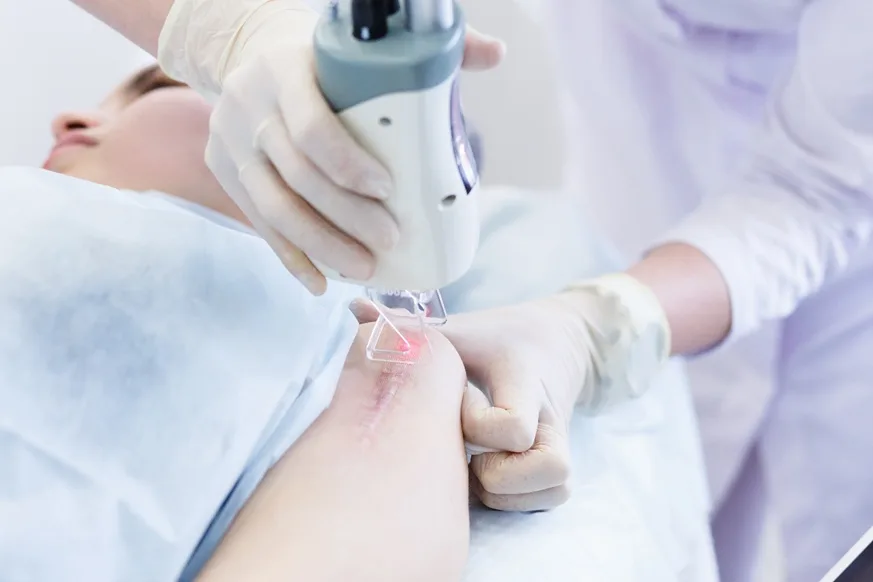 điều trị sẹo