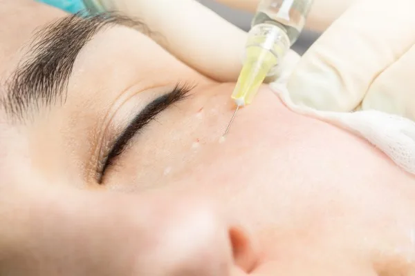 10 ngày cận tết - chăm sóc da cấp tốc cho năm Quý Mão đẹp rạng ngời