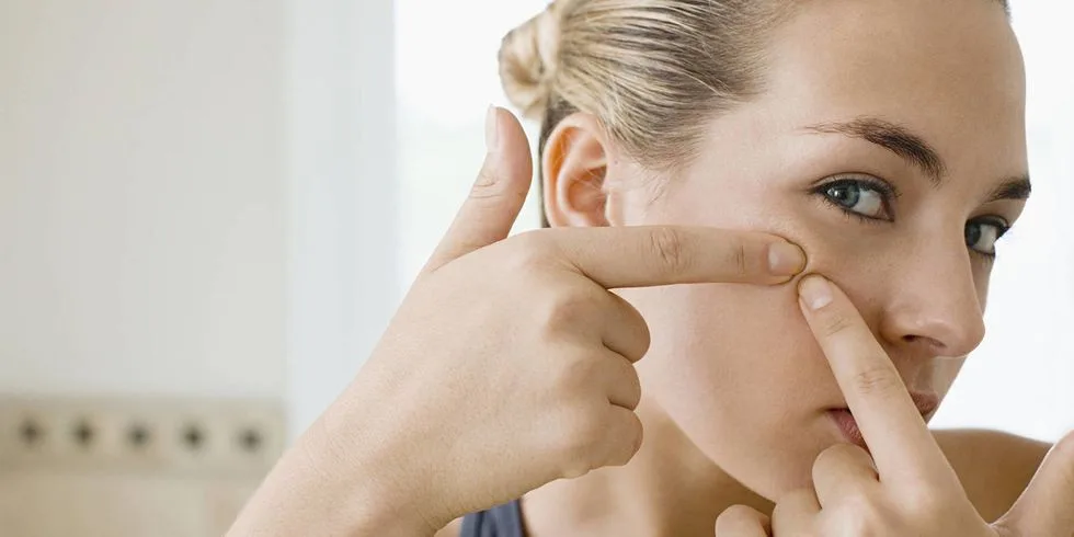 Cần cẩn thận với các loại mỹ phẩm khác khi sử dụng hai dưỡng chất trị mụn này để đạt hiệu quả tốt nhất cho làn da. Ảnh: Gettyimages. trị mụn bằng mỹ phẩm