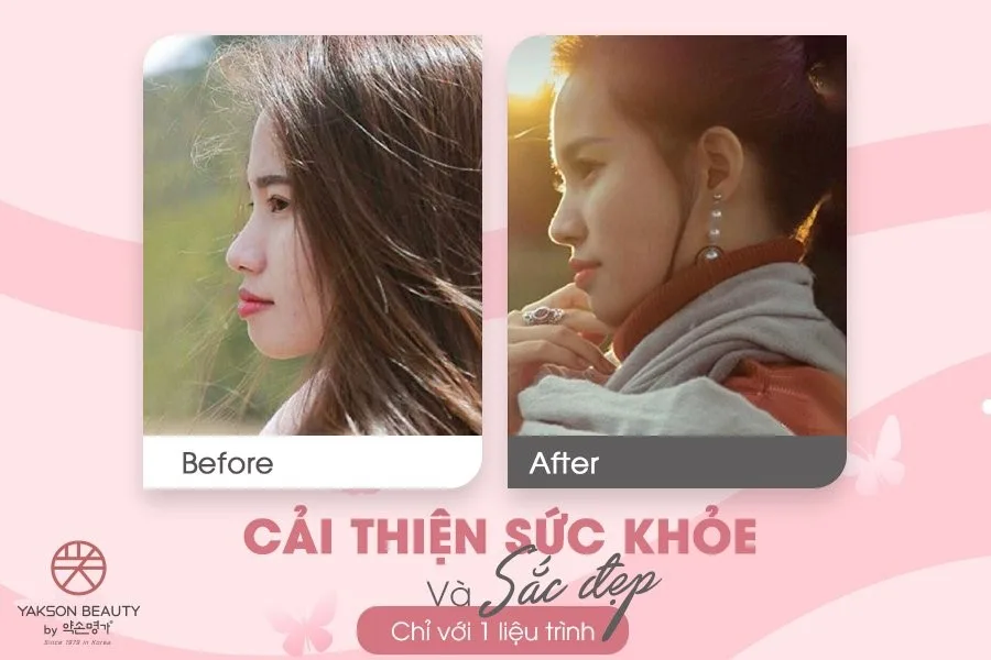 liệu pháp golki liệu pháp golki