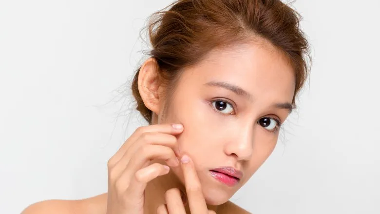 chăm sóc da trị mụn chăm sóc da trị mụn