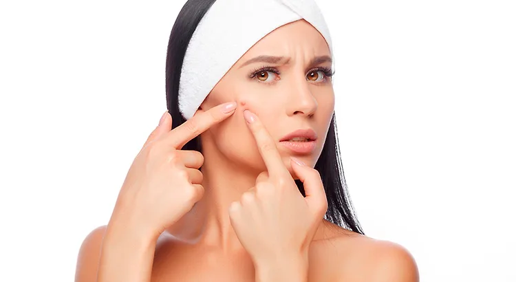 mụn trứng cá 8 mụn trứng cá 8
