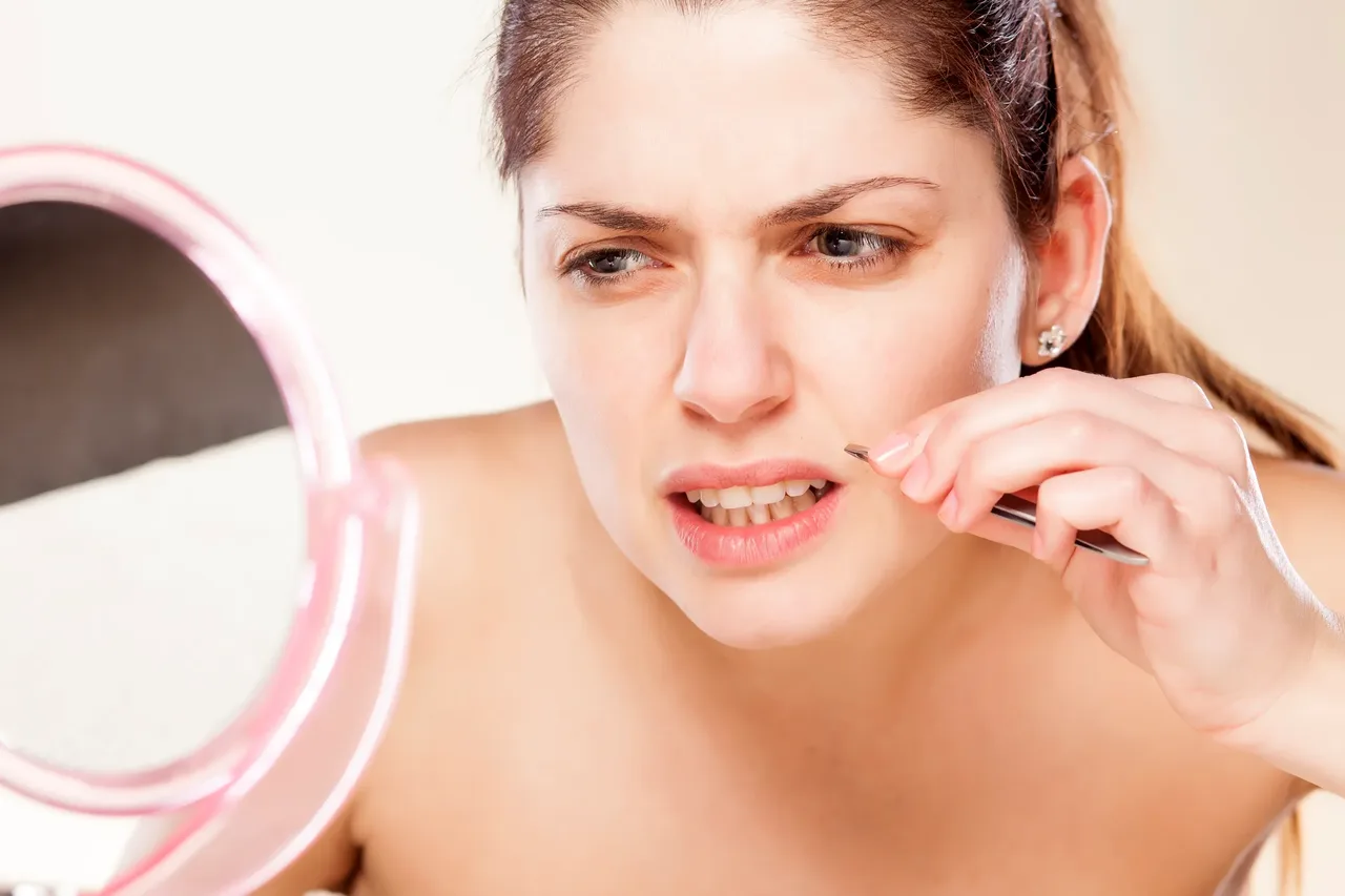 Ria mép gây ảnh hưởng đến tính thẩm mỹ của gương mặt