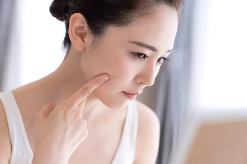 Dấu hiệu da bị stress Dấu hiệu da bị stress